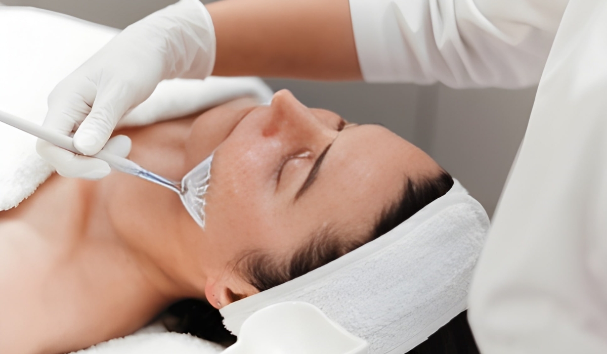 best chemical peel treatment near Jubilee Hills